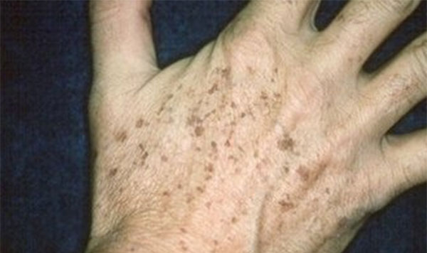 �������ôȥ�� ���Ԥ������ߵ��γ�